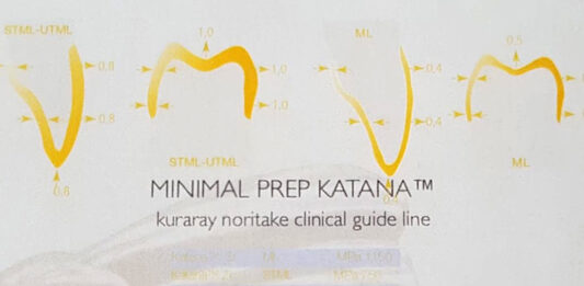 PERCHÉ E IMPORTANTE LA CEMENTAZIONE?