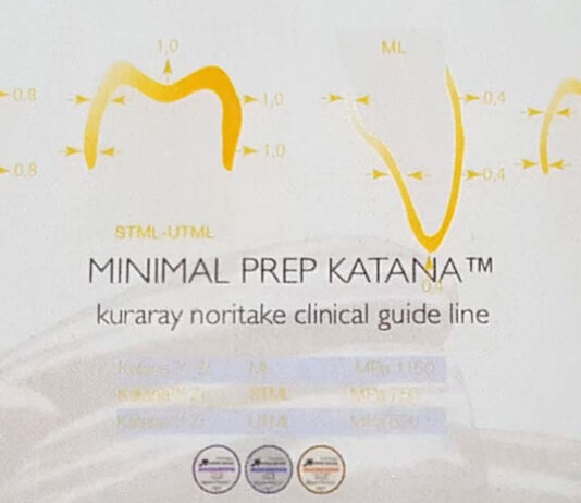 PERCHÉ E IMPORTANTE LA CEMENTAZIONE?