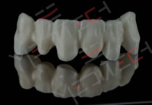 Strutture e Sostegni – Portanti e secondari