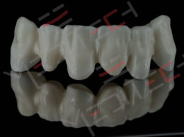 Strutture e Sostegni – Portanti e secondari