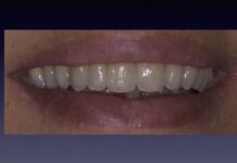 Progettazione ed esecuzione di un Framework in Zirconio