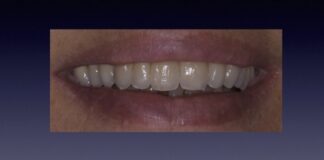 Progettazione ed esecuzione di un Framework in Zirconio